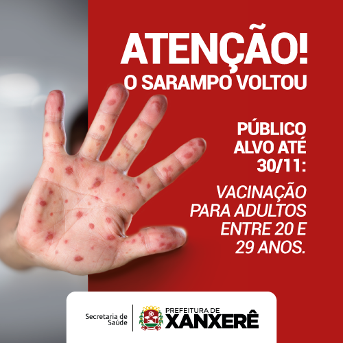 You are currently viewing Secretaria de Saúde promove um Dia D em todas as unidades de Xanxerê